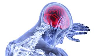 8 תסמינים שיכולים לעלות חשש לגידול סרטני במוח