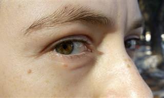 6 בעיות בעיניים שמעידות על מחלות גופניות