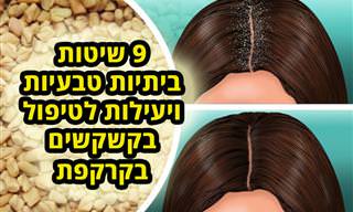 9 שיטות ביתיות טבעיות לטיפול בקשקשת