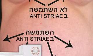 MommyCare סיפור של הצלחה