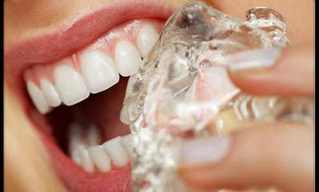 19 טיפים למניעת נזק לשיניים