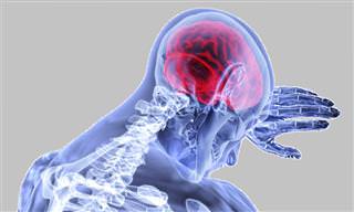 שבץ מוחי - מהם הגורמים איך מזהים וכיצד ניתן לטפל?