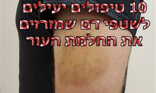 10 שיטות טיפול טבעיות לשטפי דם ונפיחויות בעור
