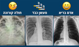 תמונה להמחשה: מה קורה לריאות שלכם בעקבות קורונה