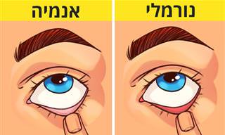 7 בדיקות ביתיות פשוטות שיגלו לכם מה מצבכם הבריאותי
