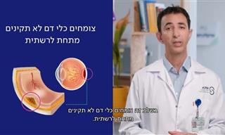 ד